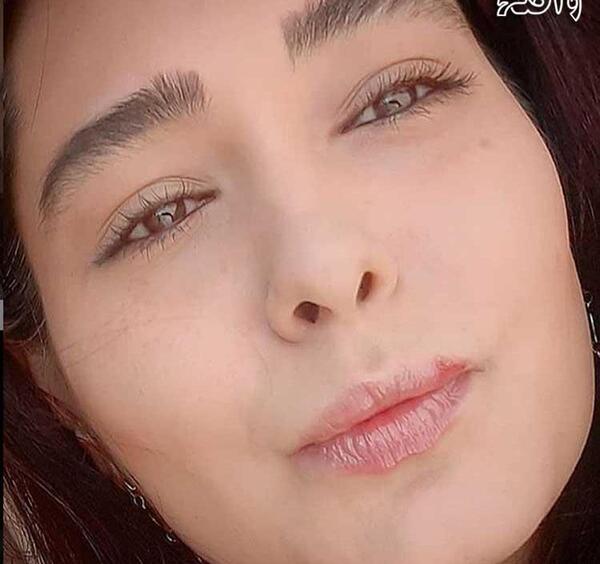 عکس های سانیا سالاری قبل از عمل زیبایی