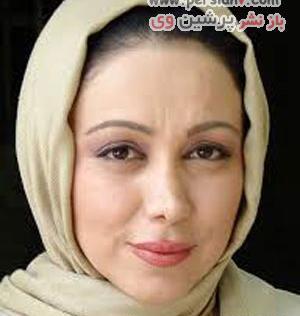 عکس فاطمه گودرزی قبل و بعد عمل