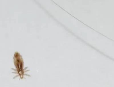 عکس شپش مرده