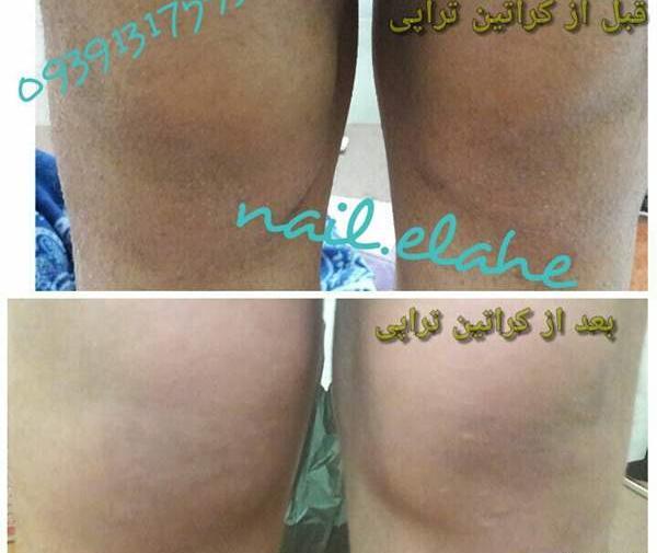 عکس زانو نی نی سایت