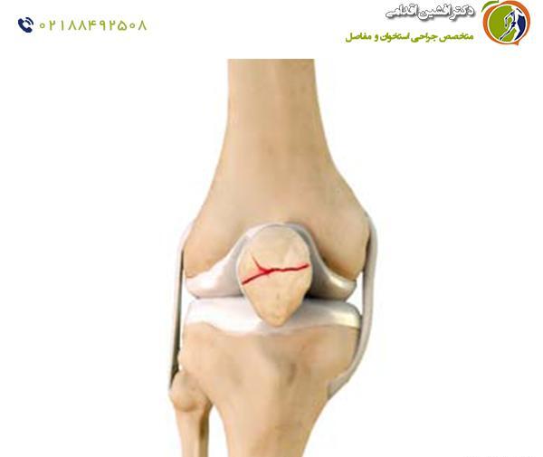 عکس زانو نی نی سایت