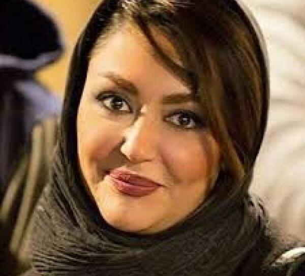عکس شقایق فراهانی قبل از عمل