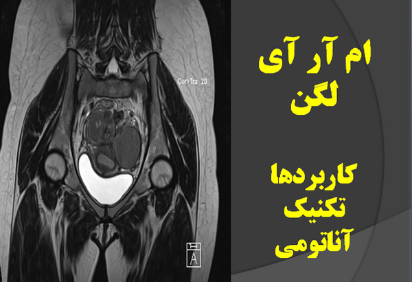 عکس ام ار ای لگن