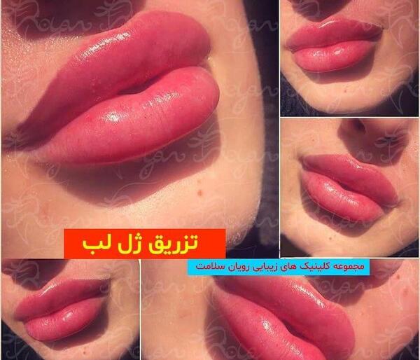عکس لب قلبی