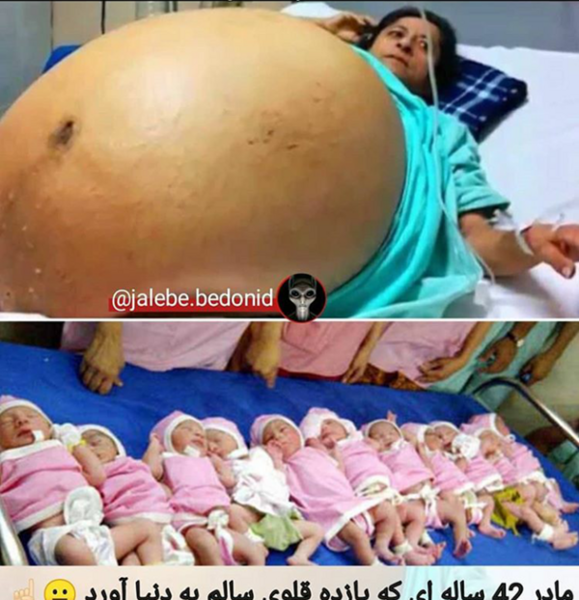 عکس زن یازده قلو