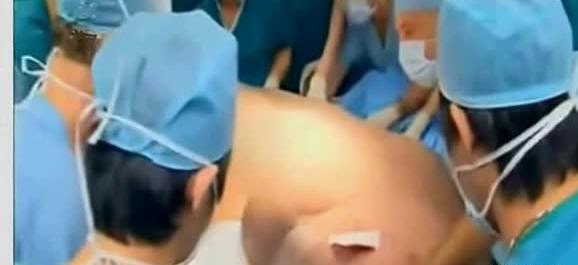 عکس زن یازده قلو