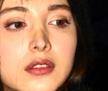 عکسهای روشنک گرامی قبل از عمل