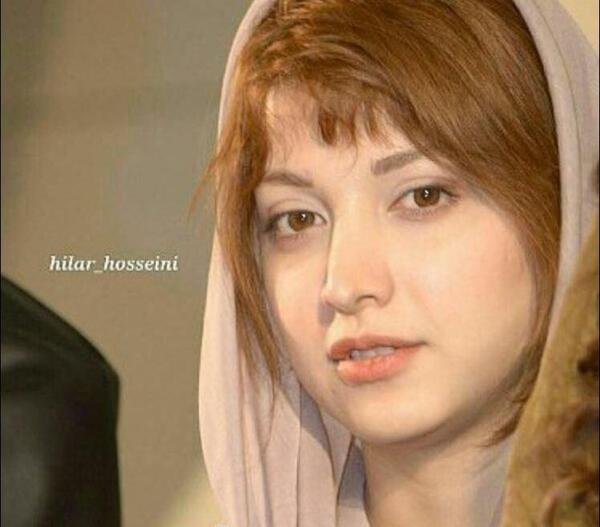 عکسهای روشنک گرامی قبل از عمل