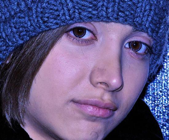 عکسهای روشنک گرامی قبل از عمل
