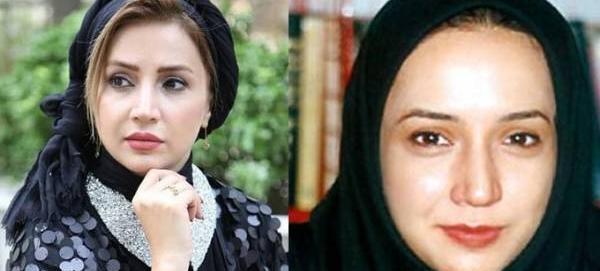 عکس لیندا کیانی قبل و بعد از عمل