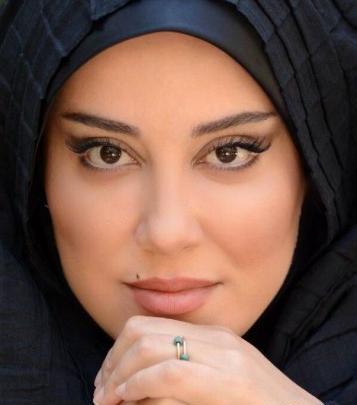 عکس اشا محرابی قبل عمل