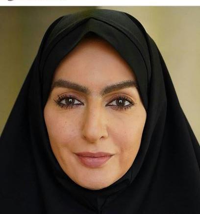 عکس شقایق دهقان قبل و بعد از عمل زیبایی