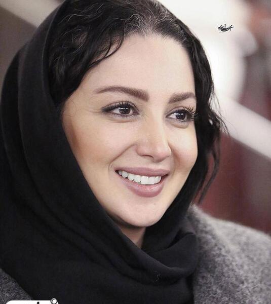 عکس شیلا خداداد قبل و بعد عمل