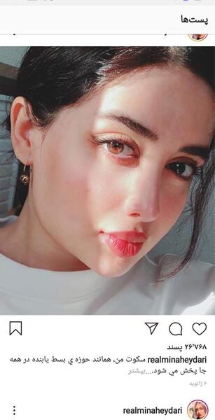 عکس مینا حیدری قبل عمل