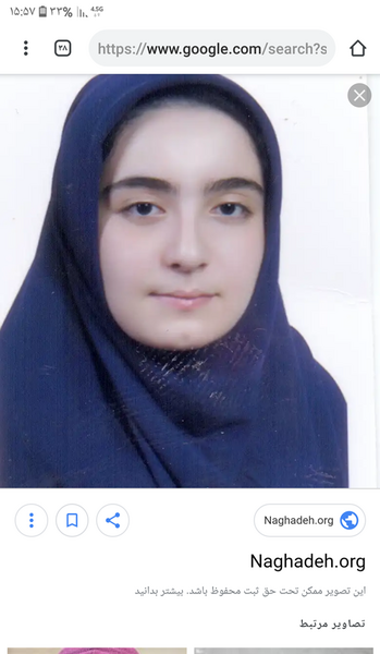 عکس مینا حیدری قبل عمل