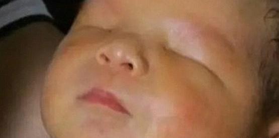 عکس چشم چینی