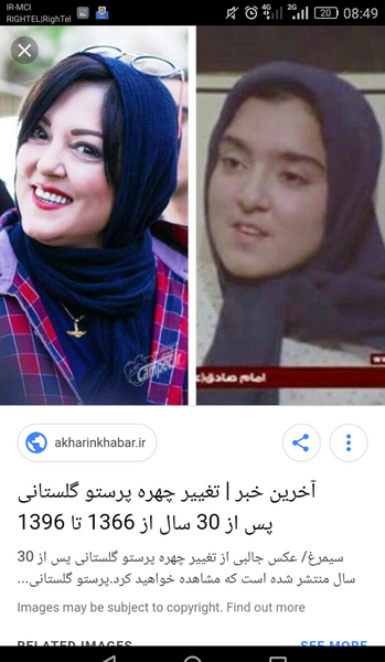 عکس پرستو گلستانی قبل از عمل