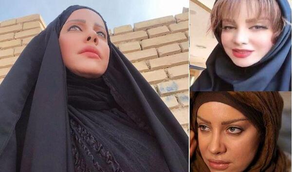 عکس شراره رخام قبل و بعد از عمل