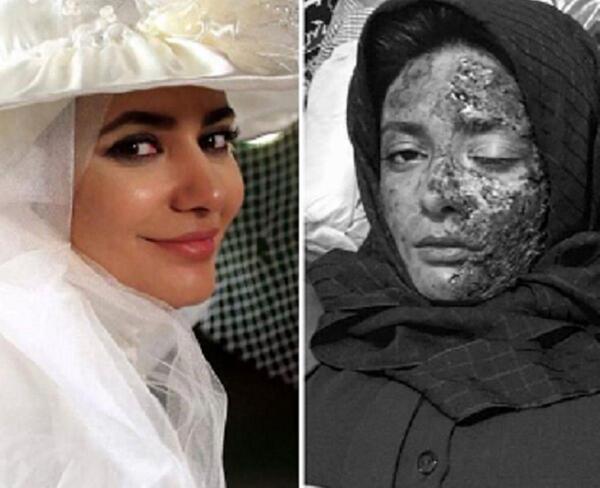 عکس لیندا کیانی در لباس عروس