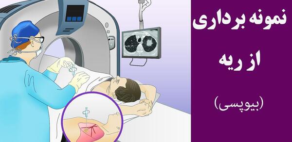 عکس برداری ریه چگونه است