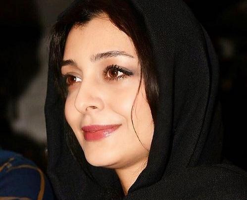عکس ساره بیات قبل از عمل زیبایی