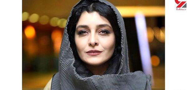 عکس ساره بیات قبل از عمل زیبایی