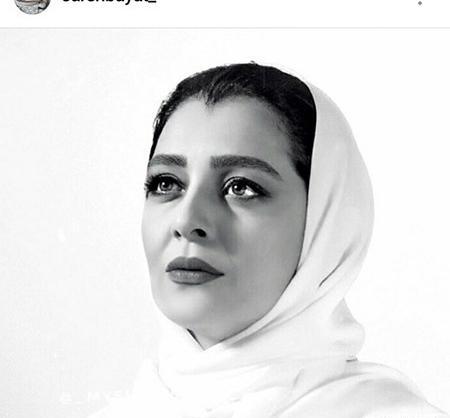 عکس ساره بیات قبل از عمل زیبایی