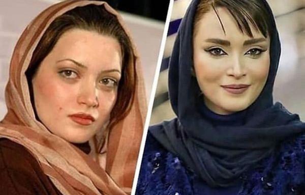 عکسهای طناز طباطبایی قبل از عمل بینی