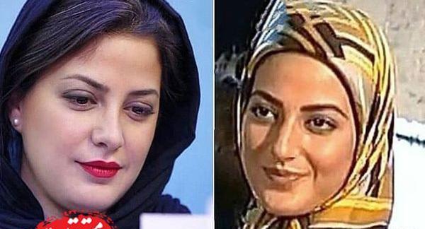 عکسهای طناز طباطبایی قبل از عمل بینی