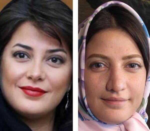 عکسهای طناز طباطبایی قبل از عمل بینی