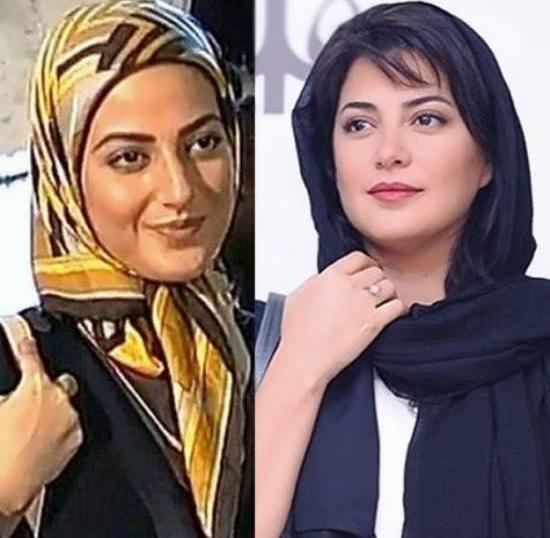 عکسهای طناز طباطبایی قبل از عمل بینی