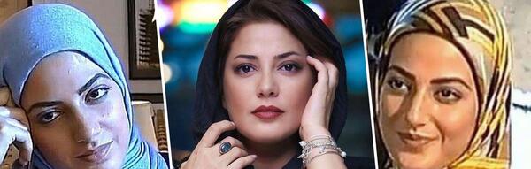 عکسهای طناز طباطبایی قبل از عمل بینی