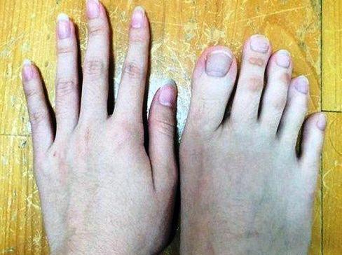 عکس دونفره دست و پا