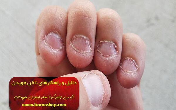 عکس ناخن جویده شده