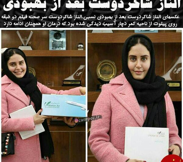 عکس الناز شاکردوست بعد عمل