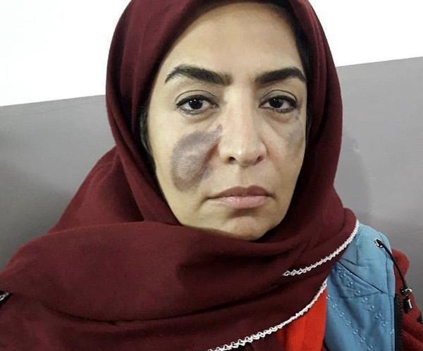 عکس های جدید ساناز سماواتی