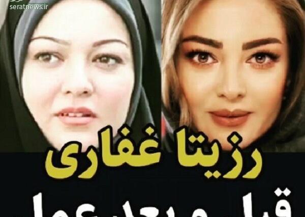 عکس لاغری رزیتا غفاری