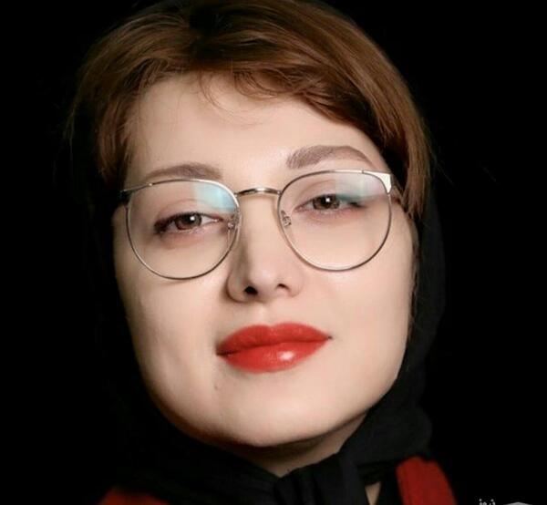 عکس های روشنک گرامی قبل از عمل بینی