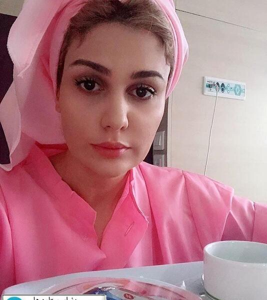 عکس های روشنک گرامی قبل از عمل بینی