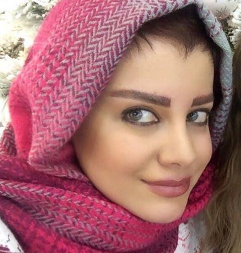 عکس های روشنک گرامی قبل از عمل بینی