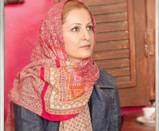 عکس شقایق دهقان قبل از عمل