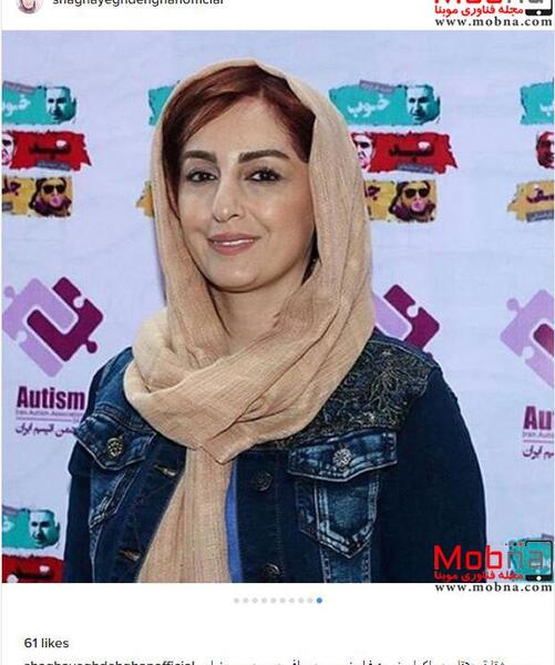 عکس شقایق دهقان قبل از عمل