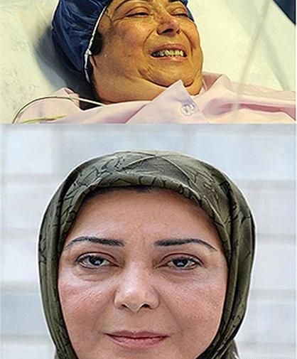 عکس هایی از پروین دخت یزدانیان