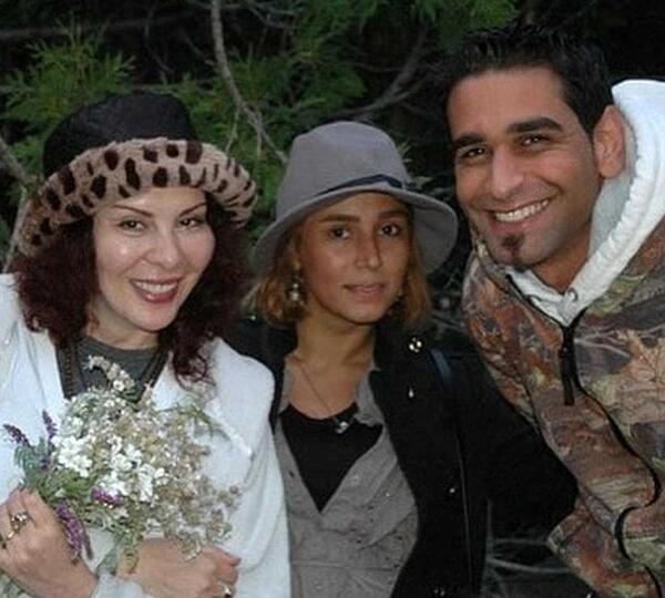 عکس افسانه بایگان قبل از عمل زیبایی