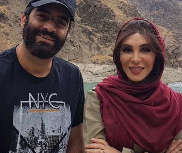 عکس افسانه بایگان قبل از عمل زیبایی