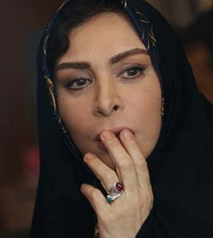 عکس افسانه بایگان قبل از عمل زیبایی