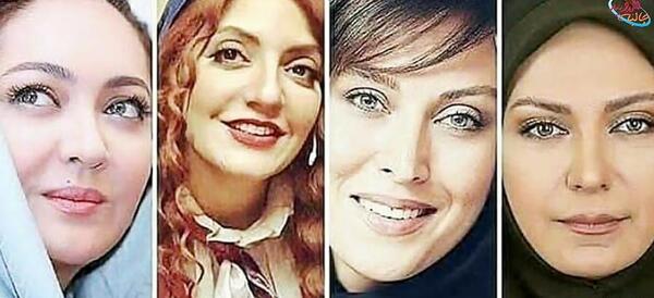 عکس آشا محرابی قبل از عمل بینی