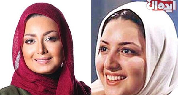 عکس آشا محرابی قبل از عمل بینی