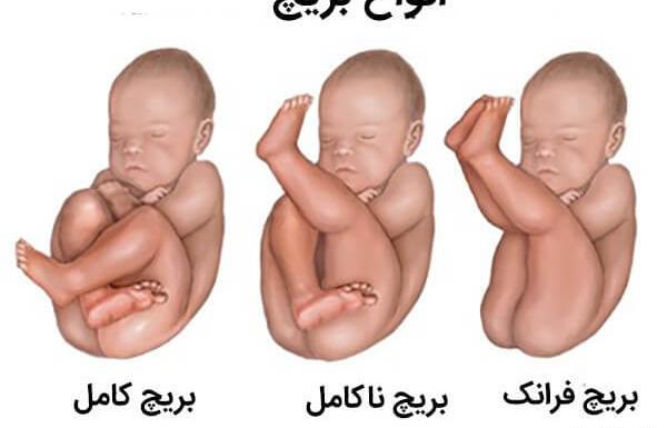 عکس جنین ایستاده