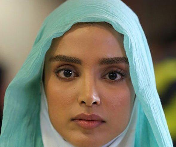 عکس الهه حصاری قبل عمل